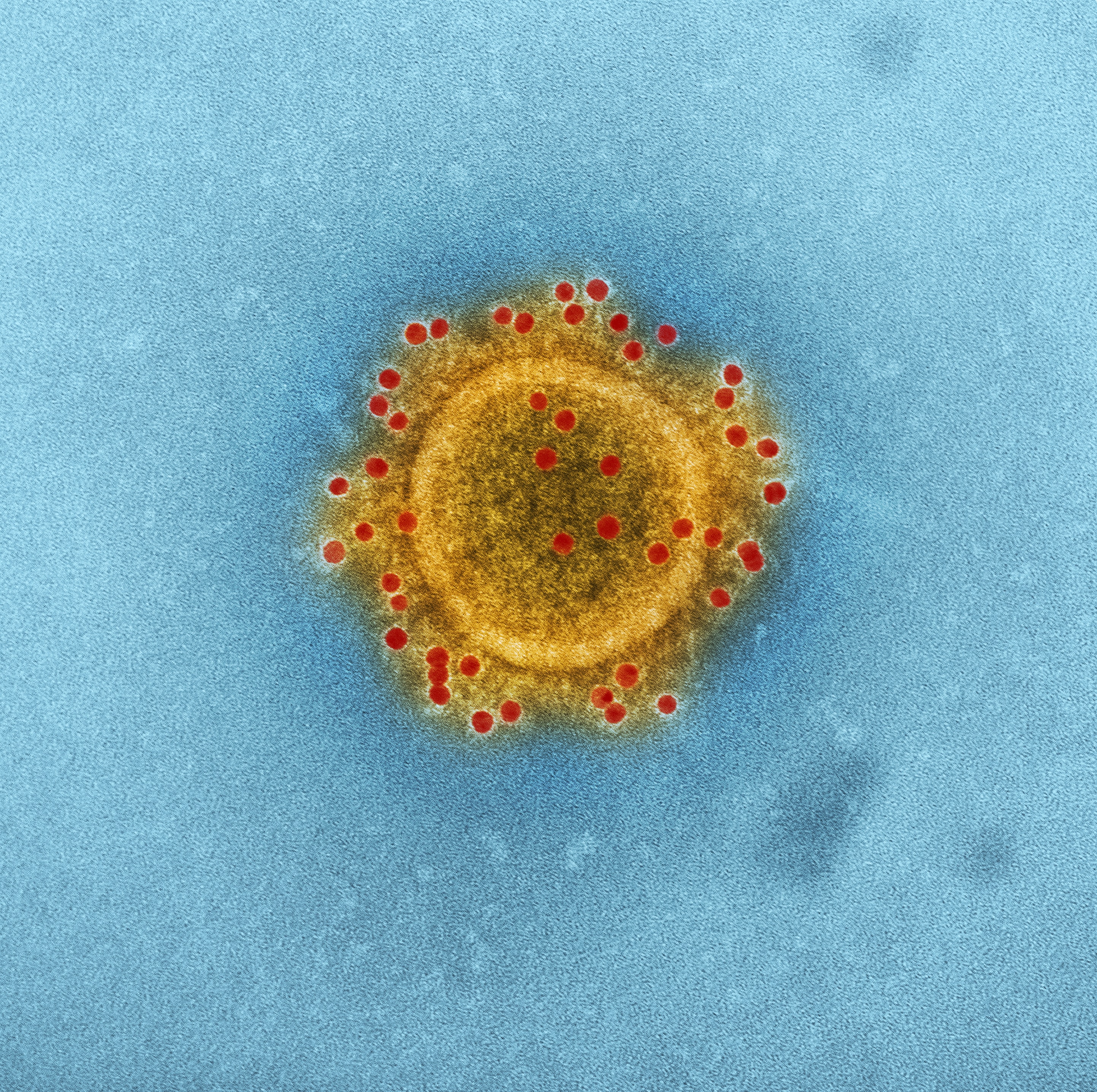 Imagem microscópica do coronavírus MERS-COV, produzida pelo Instituto Nacional de Doenças Infecciosas e Alérgicas - CDC/Unsplash