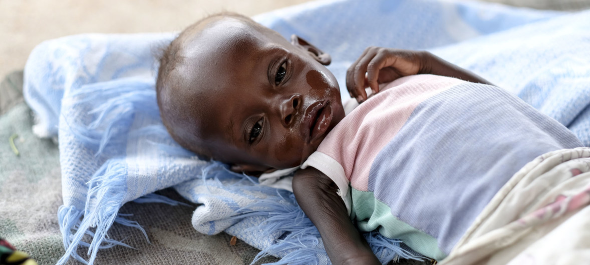 Menino de oito meses de idade com desnutrição grave no Hospital Infantil Al Sabbah em Juba, Sudão do Sul. Foto: UNICEF/Sebastian Rich